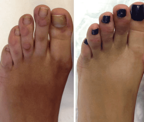 КОРЕЙСЬКА ЯКІСТЬ ПРОТИ МОЗОЛІВ