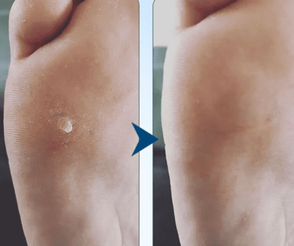 КОРЕЙСЬКА ЯКІСТЬ ПРОТИ МОЗОЛІВ